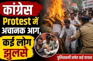 छतरपुर में विरोध प्रदर्शन के दौरान बड़ा हादसा, पुतला दहन में कई कार्यकर्ता और पुलिसकर्मी झुलसे